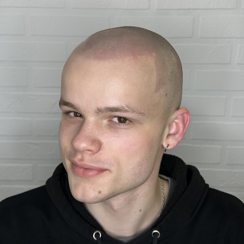 ...